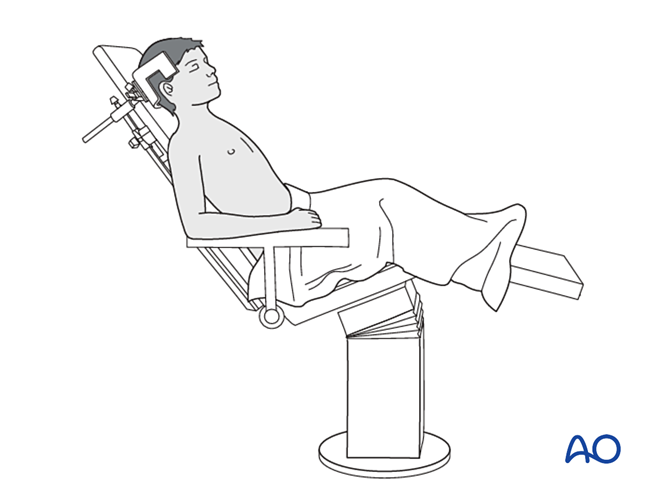 Beach Chair Positioning for Shoulder Surgery